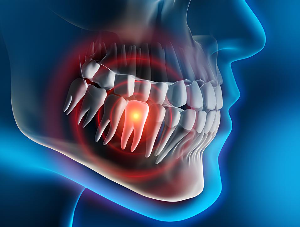 Teeth image - Emergency dentist Didcot